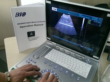 PC basierte B/tragbaren Ultraschall-Scanner W Gewicht 15 das Zoll Laptop-Schirm-nur 5kgs, das bequem ist zu tragen