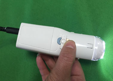 Elektronischer Colposcope vaginale Kamera-Digital, zum von Krankheit des Halses Eealier zu finden