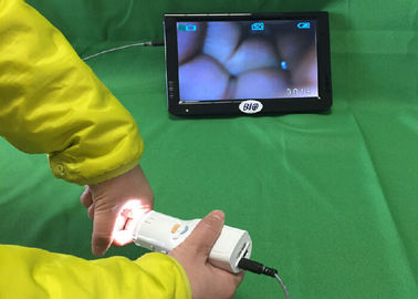 X elektronischer Colposcope von 1,5 Digital der linearen Wiedergabe schließen an Fernsehen oder Computer oder medizinischer Monitor für Frauen 's-Gesundheit an