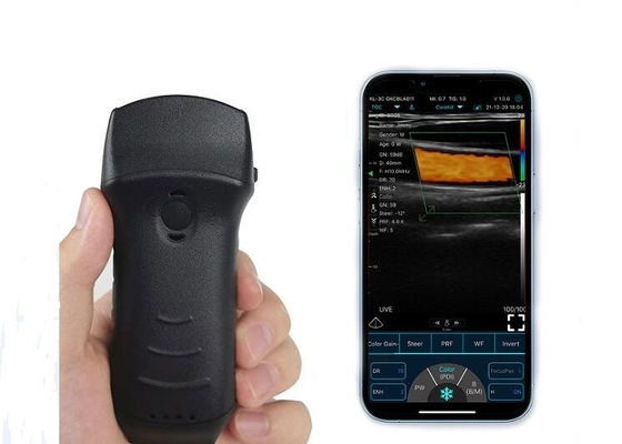 Tragbarer 305-mm-WLAN-Ultraschall-Blasenscanner, konvex + linear + Herzsonde
