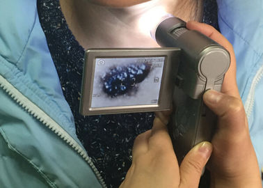 Elektronische Haut-und Haar-Prüfmittel Video-Dermatoscope-Kamera mit 3 Zoll TFT-Farbbildschirm