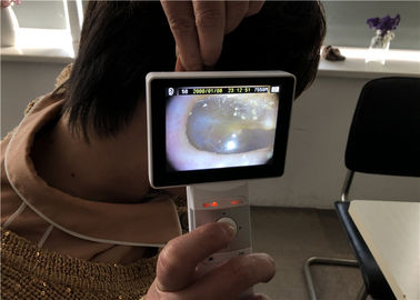 Lcd überwachen Digital-Videootoscope-Ophthalmoskop für klinische Inspektion des menschlichen Körpers