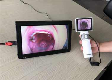 Tragbares Otoscope-Ophthalmoskop-Videokehlkamera Dermatoscope mit Sd-Kartenausgabe für Klinik