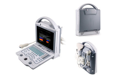 Digital-Farb-Doppler-Maschinen-Laptop-Ultraschall-Scanner-Diagnosefarbsystem