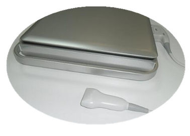 Doppler-Ultraschall-Scanner der Farbe-3d/Hand-Doppler mit eingebauter Batterie