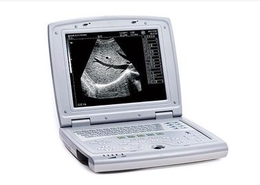 Ultraschall-Scan-Maschinen-tragbarer Ultraschall-Scanner mit Monitor dem 10,4 Zoll-LED