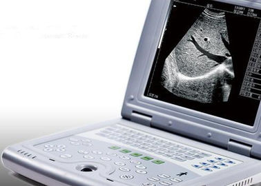 Tragbare Ultraschall-Maschine für Schwangerschafts-tragbares Ultraschall-Scanner-nur Gewicht 2.2kgs