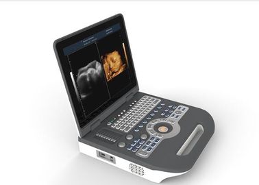 Ultraschall-Ausrüstung medizinische des Ultraschall-Maschinen-tragbare Ultraschall-Scanner-4d