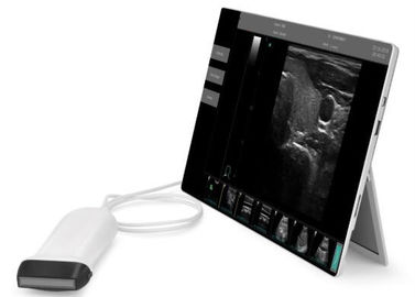 Taschen-Ultraschalldiagnoseausrüstungs-tragbarer Ultraschall-Scanner gestützter Fenster 10 TIERARZT Gebrauch verfügbar
