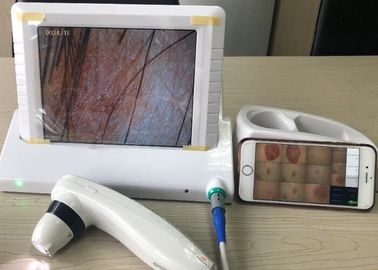 Digital Hand- Video-Dermatoscope mit 8-Zoll-Bildschirm 1,4,9 stellt das Anzeigen dar