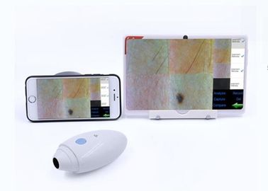 Haut-Haar-Scanner-Radioapparat HD Digital stützte der Video-Dermatoscope, der an Mobilophone angeschlossen wurde, IOS Andriod