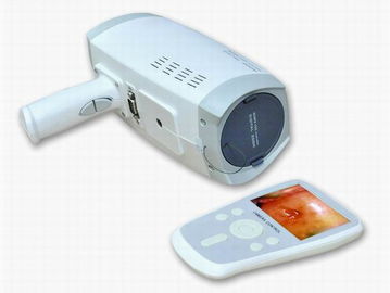 Pixel-Digital der Objektivauflösungs-800000 elektronischer Colposcope mit automatischem elektronischem Verschluss 3,5 Zoll-Handschirm