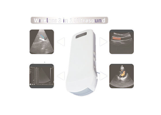 Farb-Doppler-Sonography-Farb-Doppler-Ultraschall-Scanner mit eingebautem WiFi-Signal drahtloses Aufladungs2.5mhz~10mhz Freq
