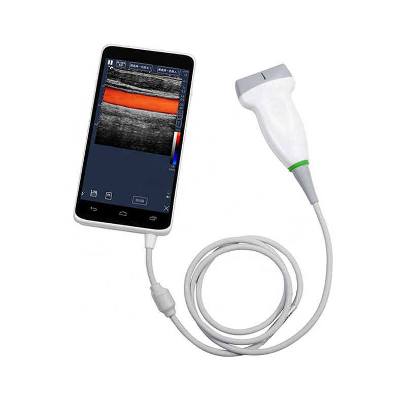 USB-Farbhandultraschall-Scanner, tragbarer Ultraschall-Gerät-Leichtgewichtler