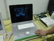Populärer Laptop-Veterinärultraschall-Scanner-leichtes einfaches 3D Digital zu tragen