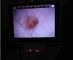 Lcd überwachen Digital-Videootoscope-Ophthalmoskop für klinische Inspektion des menschlichen Körpers