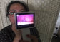 Videokamera-Digital-Otoscope HNOendoskopie Rhinoscopy medizinischer für die Nase, die mit LCD-Bildschirm überprüft