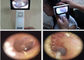 intelligenter medizinischer USB Videootoscope 1920 x 1080 Pixel CMOS für Ohr-Haut und allgemeine Darstellung