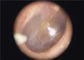 Wegwerfohrenschützer verfügbarer medizinischer tragbarer Otoscope Endoscope für Ohr-Augen-Kehle