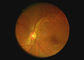 Endoscope optische Ausrüstungs-Kehlaugenkamera Videootoscope Dermatoscope Digital mit 2 Million Pixeln
