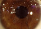 Handspaltlampe-tragbare Ophthalmoskop-Kamera