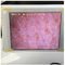 Weißer Wifi-Haut-Feuchtigkeits-Kontrolleur-Haut-Feuchtigkeits-Sensor mit dem Foto, das in Ipad anzeigt