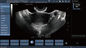 Transvaginal Sonden-Farb-Doppler-Ultraschall-Scanner, Hand-Doppler-Schwangerschaft