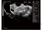 Tragbare Ultraschall-Maschine für Schwangerschafts-tragbares Ultraschall-Scanner-nur Gewicht 2.2kgs