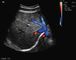 Tragbarer Schwangerschafts-Ultraschall-Scanner mit Abdominal- konvexen Transvaginal Wandlern