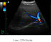 Ultraschalldiagnosegerät-tragbarer Ultraschall-Scanner Ipad mit Speicher des Bild-500G