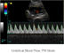 Färben Sie Doppler-Ultraschall-System-tragbaren Ultraschall-Scanner mit Monitor dem 12,1 Zoll-LED und 2 Sonden-Häfen