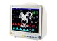 Tragbare Patientenmonitor-Haustier-Patientenmonitor-Maschinen-Tier-Tierarzt-Patientenüberwachungs-Ausrüstung mit Tierzusätzen