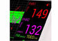 10,2“ TFT-Anzeigen-fötaler/mütterlicher Monitor-geduldiger Herz-Monitor mit Thermal-Drucker der Einbauten-152mm nur Gewicht 2kgs