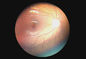 Augengerät-Digital-Fundus-Kamera Opthalmoscope mit Diopter -20~+20D Video-Entschließung von 1280 x von 960