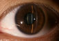 3,5&quot; Augenheilkunde-Diagnoseausrüstung für Glaukom-Diabetes