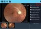 Software des Berichts-verfügbare Digital-Fundus-Kamera-Fernmedizin-Augengerätes mit wieder aufladbarer Lithium-Batterie