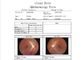 Ophthalmoskop Pixel tragbare Handder fundus-Kamera-Fernmedizin-verfügbare Videoentschließungs-1280 x 960