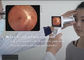Tragbare Augensystem-Digital-Fundus-Handkamera mit der hochauflösenden Fernmedizin der Linsen-1080P verfügbar