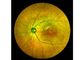 Augenausrüstung Retina Angiograph Digital 160°