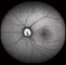 Confocal Fundus-Kamera Retina Opthalmoscope Digital mit FOV 15°, 30°, Größe 1024*1024 des Bild-60°