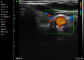 Ultraschall-Scanner-tragbare Farb-Doppler-Abdominal- Gefäßkinderheilkunde-Gynäkologie-Anwendung Ipad Hand-