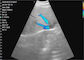 Ultraschall-Gerät-Handkonvexer Körper Digital beweglicher tragbarer + linearer + Herz-drahtloser Wandler des Ultraschall-3IN1