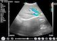 Haupt- Doppler-Ultraschall-tragbarer Diagnose- Hand-Doppler-Ultraschall-Geburts- Gynäkologie-Kinderheilkunde-Anwendung