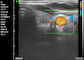 Haupt- Doppler-Ultraschall-tragbarer Diagnose- Hand-Doppler-Ultraschall-Geburts- Gynäkologie-Kinderheilkunde-Anwendung