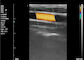 Farbultraschall-Maschinen-Hauptultraschall-Scanner-tragbarer Ultraschall für Schwangerschaft 8 TGC 3.5~10 MHZ