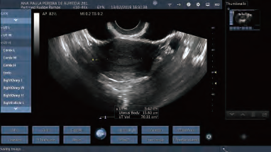 Transvaginal Ultraschall-Sonden-drahtlose Ultraschall-Sonden-Farbtragbare Ultraschalldiagnosegeräte