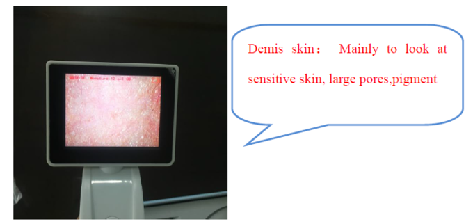 CER BS5SH Digital Haut-Analysator-Digital-Haut-Hygrometer für Doktor