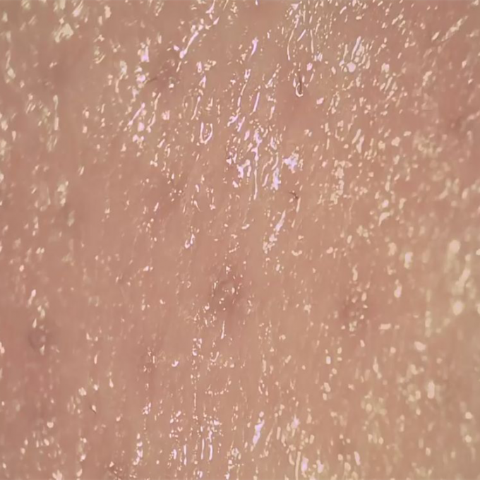 Haut-Feuchtigkeits-Detektor-drahtloser Digital-Haut-Analysator, zum der Oberfläche von Haut Derm-Poren zu beobachten