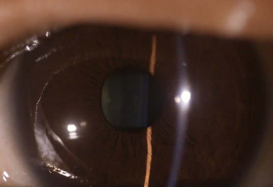 3 Linsen-verfügbares Augenausrüstungs-Digital-Fundus-Kamera-Augen-Oberflächenkamera-Augen-vorhergehende Linse austauschbar