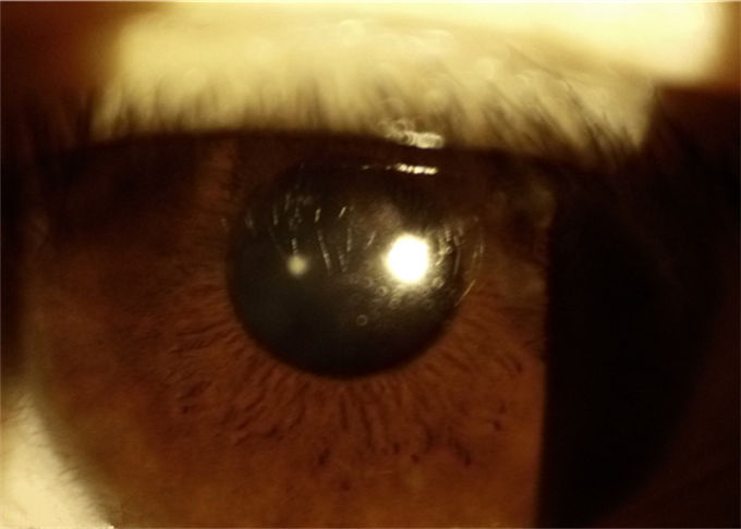 Fernmedizin-Anwendungs-Augenheilkunde-Gerät-tragbare Spaltlampe mit aufgeschlitzter Breite 0-12mm ununterbrochen justierbar